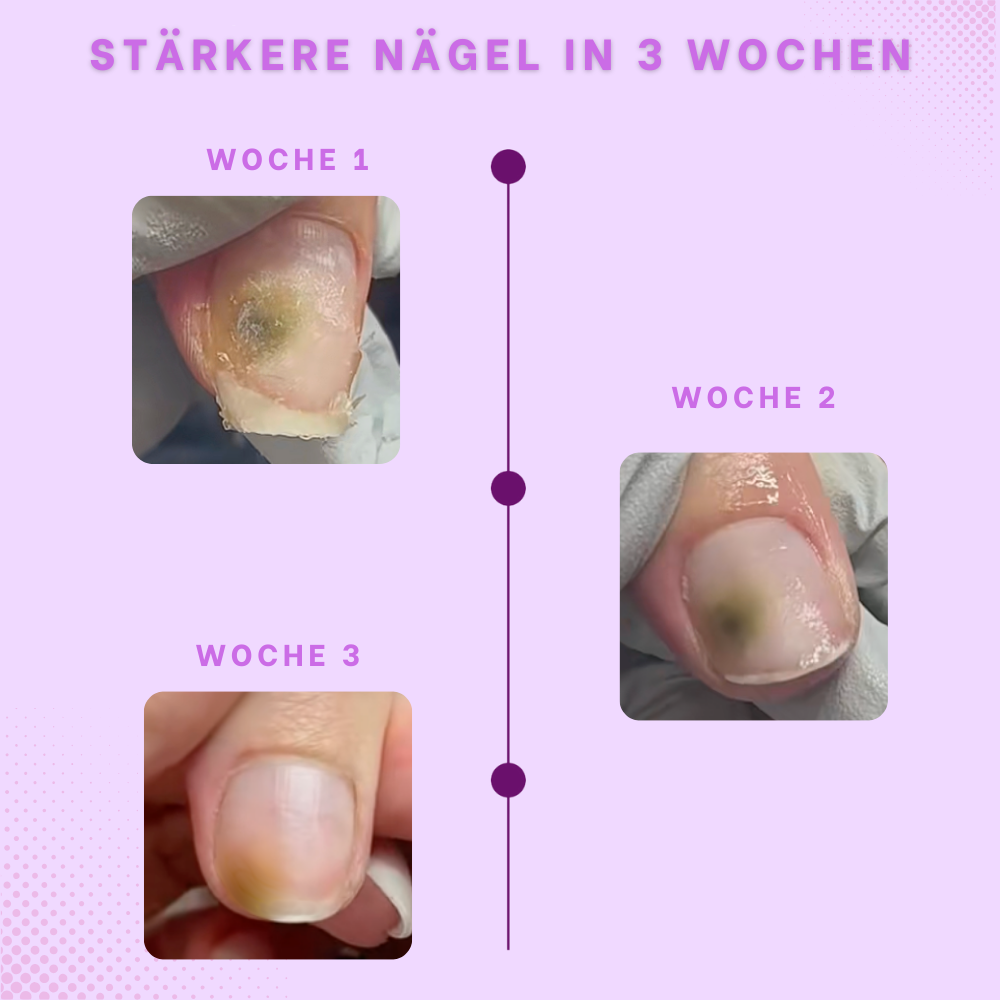 Auréla - Nagelhautschieber Stift