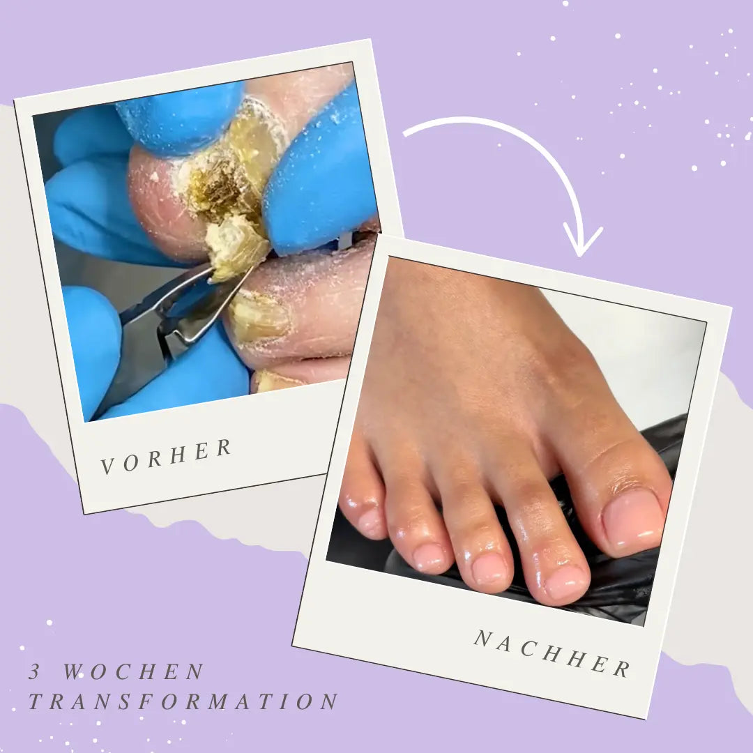 Auréla - Nagelhautschieber Stift