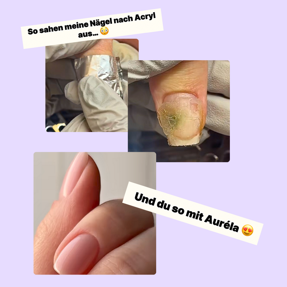 Auréla - Nagelhautschieber Stift