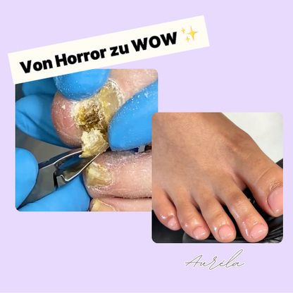 Auréla - Nagelhautschieber Stift