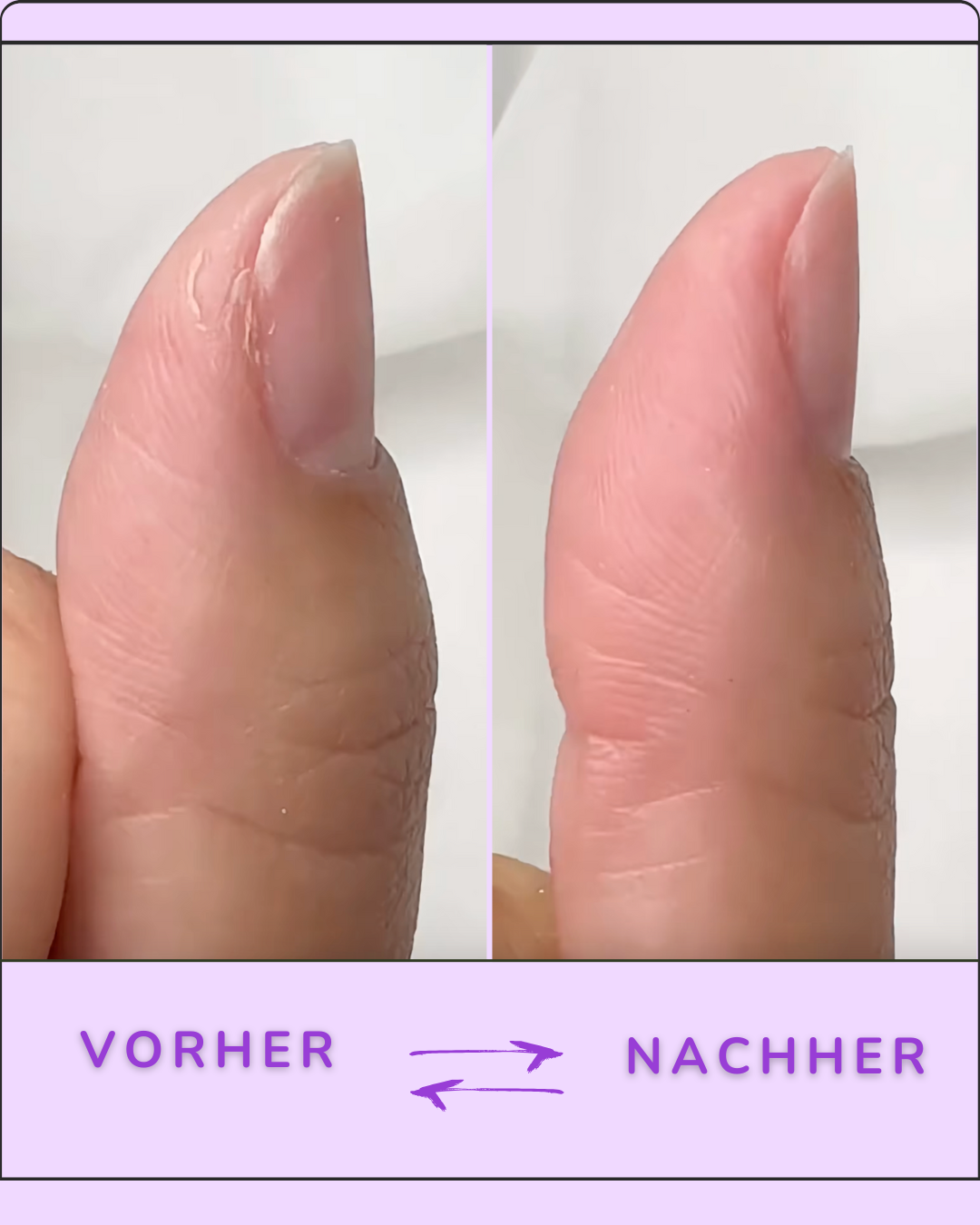 Auréla - Nagelhautschieber Stift