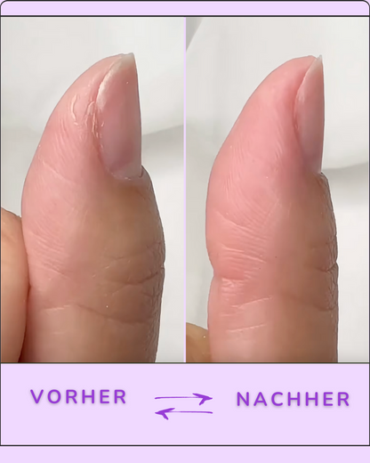 Auréla - Nagelhautschieber Stift